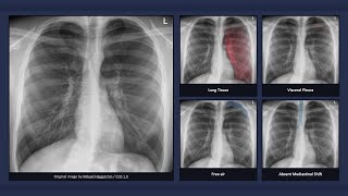 How to Interpret a Chest XRay Lesson 1  An Introduction [upl. by Morgana746]