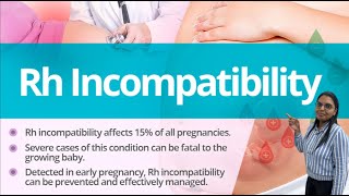 RH incompatibility jaundice [upl. by Oys482]