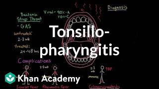 Tonsillopharyngitis  Complications diagnosis and treatment  NCLEXRN  Khan Academy [upl. by Elonore]