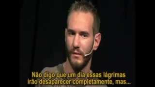 Uma Grande História de Superação  Nick Vujicic [upl. by Giule]