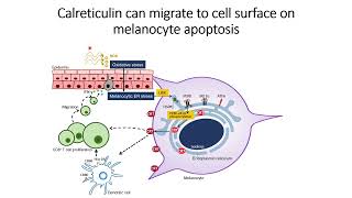 Calreticulin can migrate to cell surface on melanocyte apoptosis Code 626 [upl. by Bryce]