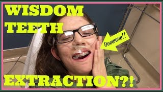 WISDOM TEETH EXTRACTION ROAD TO RECOVERY  28 MONTHS UPDATE [upl. by Ruhtracam995]