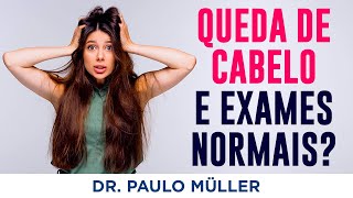 Queda de Cabelo Mesmo Com Exames Normais – Dr Paulo Müller Dermatologista [upl. by Retha]