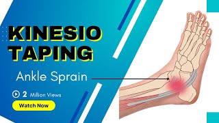 How to treat an Ankle Inversion Sprain  Kinesiology Taping to stabilise ligaments [upl. by Laerdna]