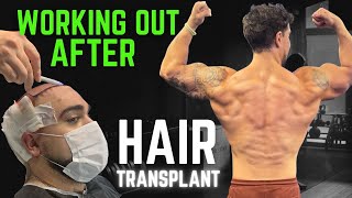 FUE Hair Transplant How Long Should You Wait to Work Out After the Surgery [upl. by Ahseekan]