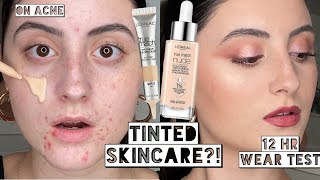 Best Makeup Day LOREAL TINTED HYALURONIC SERUM amp EYECREAM ON ACNE  10 Hour Wear Test [upl. by Yee]