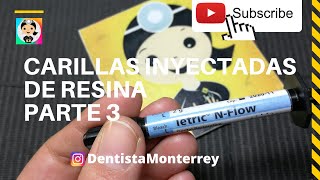 CARILLAS DIRECTAS PASO a PASO👅Parte3 Técnica de Inyección carillasderesina [upl. by Lynelle]