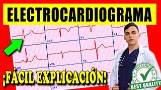 ELECTROCARDIOGRAMA Interpretación [upl. by Aneelahs175]