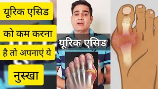 यूरिक एसिड का इलाज  uric acid ke lakshan  uric acid kam karne ke upay and dava shorts [upl. by Nabe139]