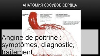 Angor  symptômes et causes de la pathologie méthodes de diagnostic et de traitement [upl. by Ruy672]