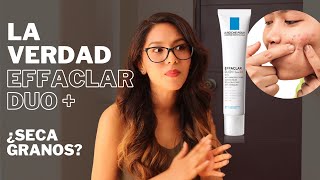 La VERDAD de EFFACLAR DUO de La Roche Posay Seca granos🆘controla el acné  Revelando ingredientes [upl. by Torie181]