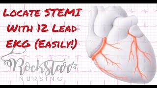 Locate and interpret STEMI based on 12 Lead EKG [upl. by Orthman534]