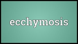 Ecchymosis Meaning [upl. by Grimbald]