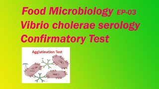 Vibrio cholerae serology  Food Microbiology EP 03 [upl. by Sabella672]