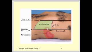 Palpation of the Liver amp Spleen [upl. by Peednama437]