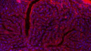 S aureus Toxins LukED and HlgAB Cause Vascular Leakage [upl. by Sekofski673]