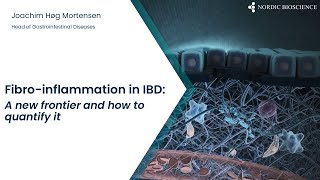 Webinar  Serum Calprotectin and Mucosal Damage in IBD [upl. by Fujio]