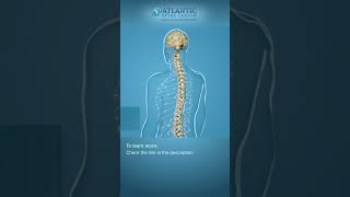 What is Cervical Lateral Stenosis Shorts [upl. by Atterahs]