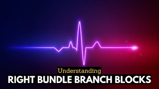 RBBB Uncovered Navigating the Complexities of Right Bundle Branch Blocks [upl. by Alicsirp]