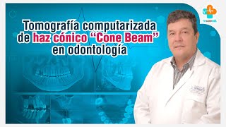 Tomografía computarizada de haz cónico quotCone Beamquot en odontología  Tu Salud Guía [upl. by Isla]