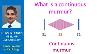 What is a continuous murmur [upl. by Doti]