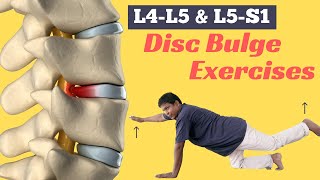 6 Best Diffuse Disc Bulge at L4L5 and L5S1 Treatment Exercises [upl. by Eatnahc154]