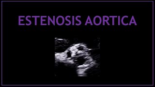 Estenosis Aortica Ecocardiografia  Cardiologia [upl. by Aciretahs]