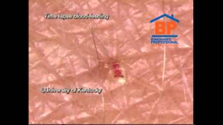 Bed Bug Time Lapse Video [upl. by Jemma]