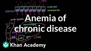 Anemia of chronic disease  Hematologic System Diseases  NCLEXRN  Khan Academy [upl. by Eicak]