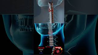 Goiter vs Normal Thyroid [upl. by Lorne]