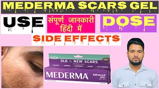 Mederma scars gel use in hindi  mederma scars gel ke fayde  usedoseside effects [upl. by Harri]