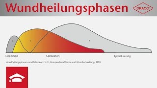 Wundheilungsphasen im Überblick  Exsudationsphase Granulationsphase Epithelisierungsphase [upl. by Tracie]