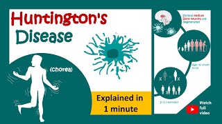 Huntingtons disease in 1 minute  1 minute pathology  Huntingtons chorea [upl. by Zaccaria362]