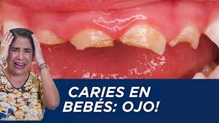 Caries en bebés ¡ojo [upl. by Aliel529]