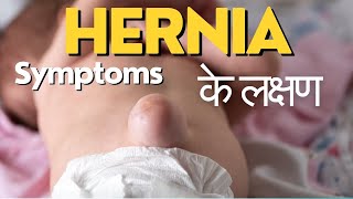 Symptoms of hernia  Hernia ke lakshan  हर्निया के लक्षण  Hernia symptoms in Hindi [upl. by Swagerty]