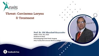 Throat  Carcinoma Larynx amp Treatment [upl. by Uaeb]