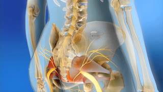 Sacral Neuromodulation  MOA Animation [upl. by Eskill993]