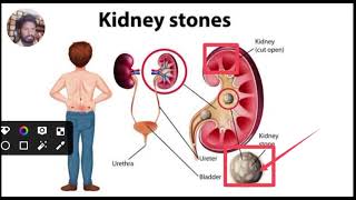 Medical Topic Videos Disease Treatment Hindi [upl. by Gorden739]