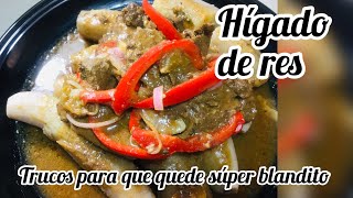 EL SECRETO para el Hígado Encebollado MAS BLANDITO [upl. by Aderf178]