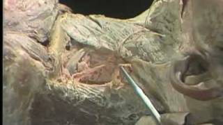 Dissection Superficial Cervical Region and Posterior Triangle of Neck [upl. by Aaberg]