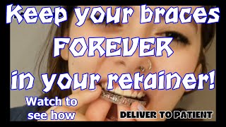 Keep your braces forever in your retainer Watch to see how [upl. by Ramunni]