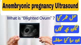 anembryonic pregnancy Urdu Hindi  blighted ovum ultrasound [upl. by Nagad]