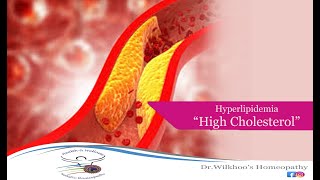 Cholesterol Facts amp Myths [upl. by Weidman402]