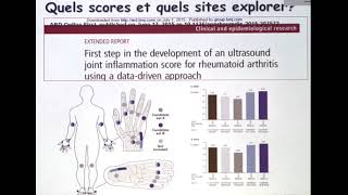 Echographie de la PR en cas cliniques 22 [upl. by Edya]