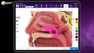 EMA helps HARMONY Center for Surgery of the Ears Nose and Throat Save Time and Streamline Workflow [upl. by Rehpotsirahc939]