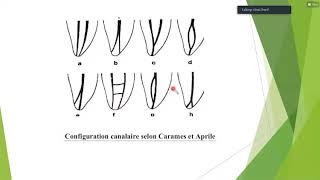 les lesions inflammatoires periapicales dorigine endodontique [upl. by Hy649]