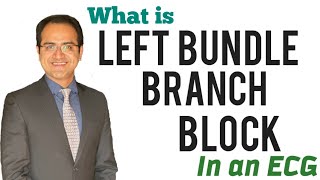 Left Bundle Branch Block LBBB ECG Made Easy LBBB ECG Explained ECG Lectures USMLE [upl. by Adaiha]