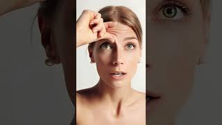 Sculptra vs Botox Diferencias en la aplicación [upl. by Daryle]