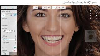 Digitized 3Shape Smile Design 2021 Workflow [upl. by Rosaline]