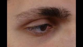 Atopic Dermatitis Eczema Leads To Thinning Eyebrows How To Overcome [upl. by Saimon]